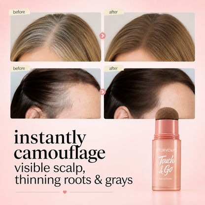 ⏰Last Day: Buy 1 Get 1 Free🎁 — Instantly Cover Roots, Grays & Sparse Hairlines