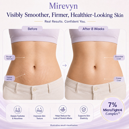 ✨ Reveal Firmer, Smoother-Looking Skin with Mirevyn Belly Cream