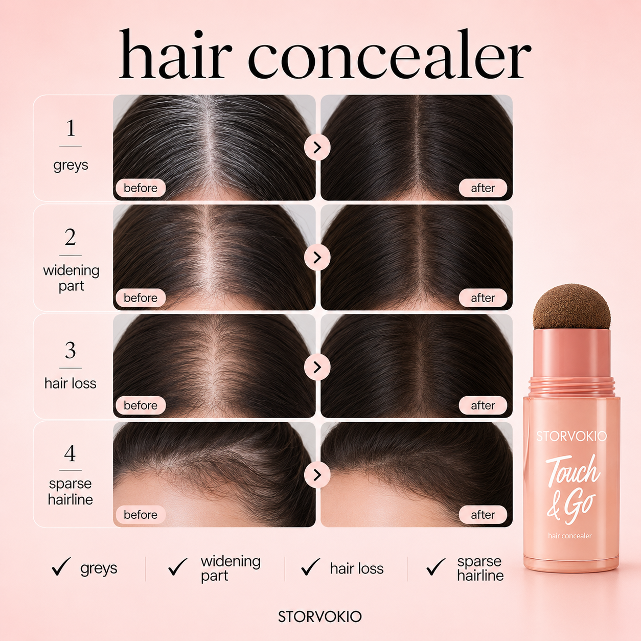 ⏰Last Day: Buy 1 Get 1 Free🎁 — Instantly Cover Roots, Grays & Sparse Hairlines