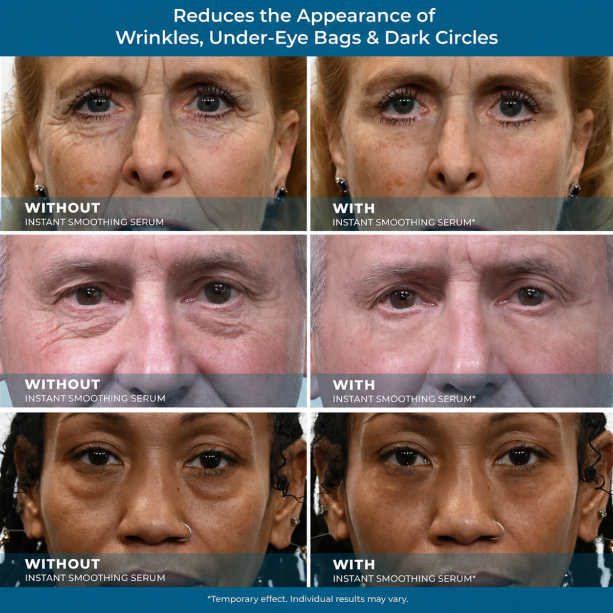 STORVOKIO Smooth, Brighter-Looking Eyes in Just 10 Minutes