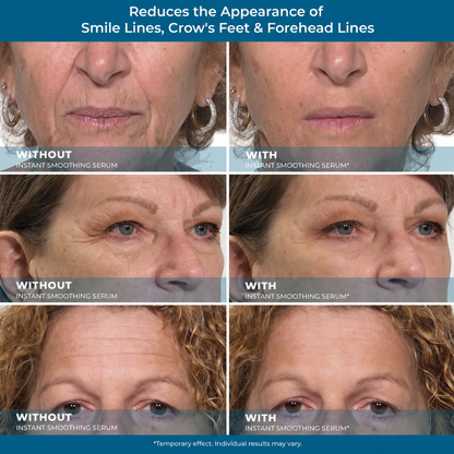 STORVOKIO Smooth, Brighter-Looking Eyes in Just 10 Minutes